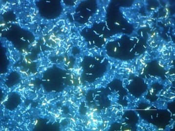 Polymicrobic biofilm epifluorescence. Courtesy of the Centers for Disease Control and Prevention.